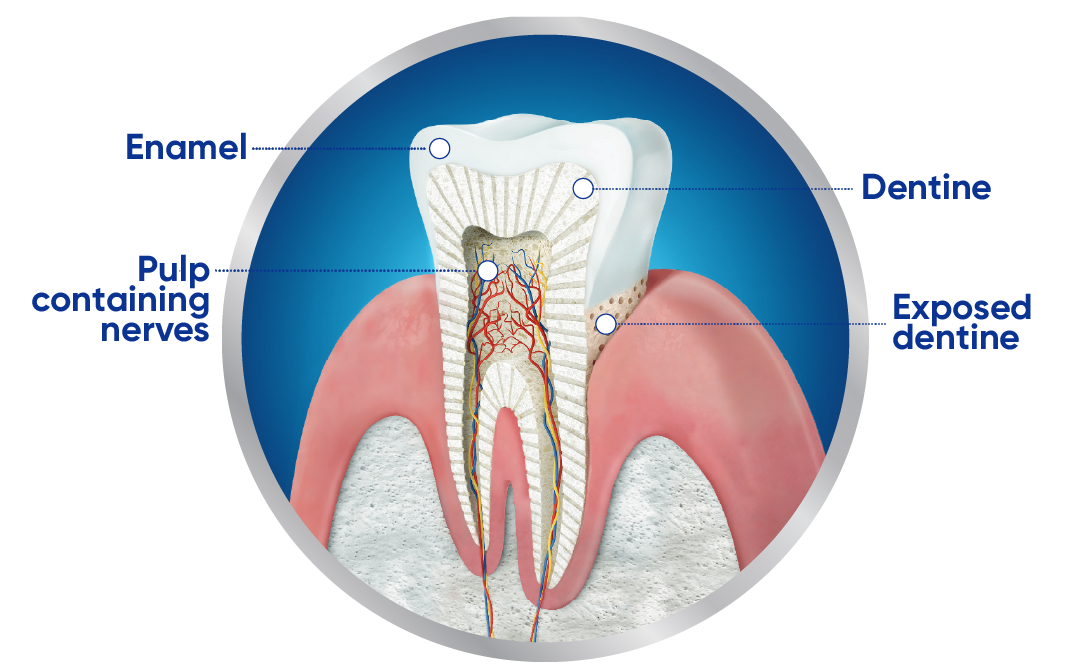 Tooth cross-section: enamel, dentine, pulp containing nerves, and exposed dentine.